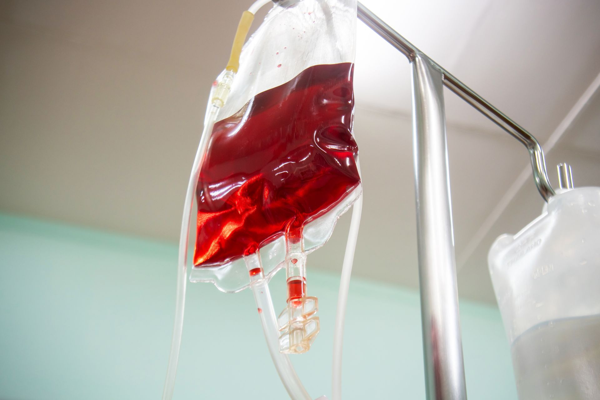 Thalasemia
